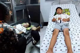 BS thắt thòng lọng nội soi gắp que kẹo mút ra khỏi họng em bé