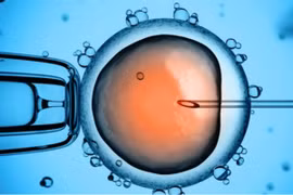 Chồng bày mưu lấy cắp phôi của vợ tại bệnh viện Bưu Điện giúp bồ mang thai