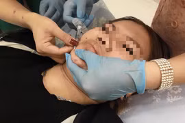 Rùng mình tay ngang làm đẹp - Kỳ cuối: Một bước thành 'bác sĩ'