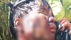 Quảng Nam: Bị Gấu rừng tấn công khi lên thăm vườn sâm, người đàn ông trong tình trạng nguy kịch