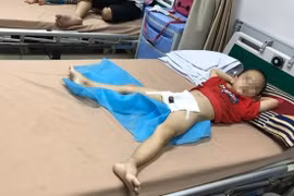 Thêm 29 bé trai Hưng Yên bị sùi mào gà