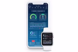 Apple Watch sắp có tính năng theo dõi giấc ngủ