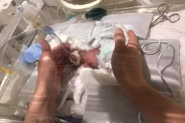 Em bé sơ sinh nhỏ như củ hành