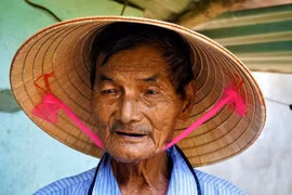 'Dị nhân' gần nửa thế kỷ không ngủ bây giờ ra sao?