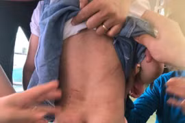 Hà Tĩnh: Tạm giữ dì ruột đánh đập cháu gái 4 tuổi gây nhiều thương tích