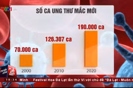 Việt Nam sẽ có khoảng 190 ngàn ca mắc ung thư vào năm 2020