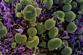 SARS-CoV-2 có thể hoạt động lâu hơn thời gian cách ly được khuyến nghị