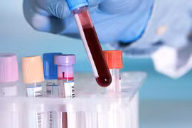 Ngày mới với tin tức sức khỏe: Phương pháp đơn giản giúp phát hiện sớm ung thư