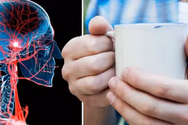 Nghiên cứu: Thức uống độc đáo giúp ngăn chặn gần 1/3 số ca đột quỵ