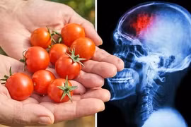 Khoa học: Loại quả thần kỳ giúp giảm đến hơn một nửa số ca đột quỵ