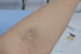 TP HCM: Sản phụ liệt nửa người sau sinh mổ tại Bệnh viện Phụ sản Mêkông