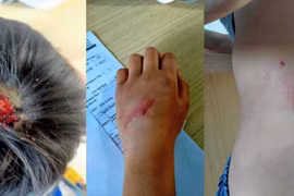 Chư Prông: Vợ tố cáo chồng bạo hành con trai 9 tuổi