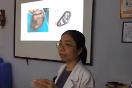 Ghép da đầu cho bé gái bị máy cưa nước đá lột gần nửa diện tích da đầu