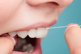 4 kiểu dùng chỉ nha khoa sai gây hại cho răng nướu