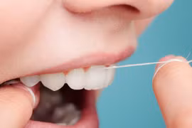 4 kiểu dùng chỉ nha khoa sai gây hại cho răng nướu