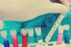 155 người tử vong do dịch sốt Lassa ở Nigeria