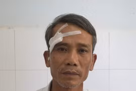 Gia Lai tạm giữ đối tượng có hành vi giết người