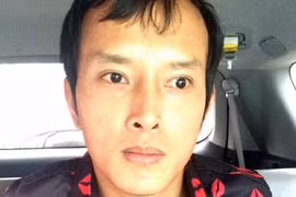 Trốn nã, trùm ma túy phẫu thuật thẩm mỹ đổi nhận dạng