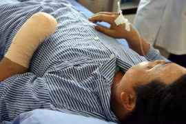 Đèn pin phát nổ, người đàn ông dập nát xương đốt bàn tay trái