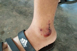 Khỉ đuôi lợn tấn công làm bị thương trung tá công an