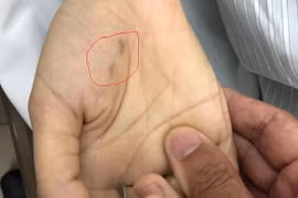 Hà Nội: Nữ bác sĩ thú y tử vong do chó dại cắn