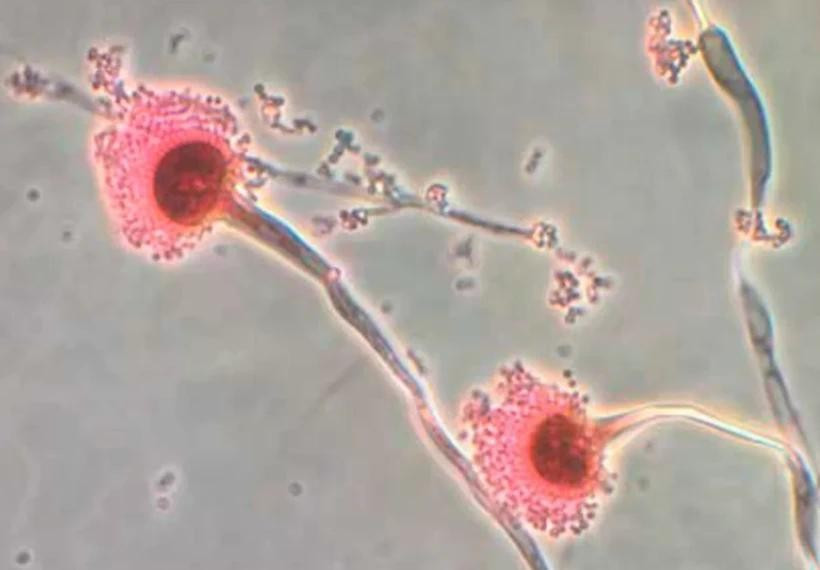 Nấm Aspergillus được cho là sẽ mở rộng phạm vi lây lan và ảnh hưởng khi Trái đất nóng lên. (Nguồn: CNN) baodongloai-nam.jpg