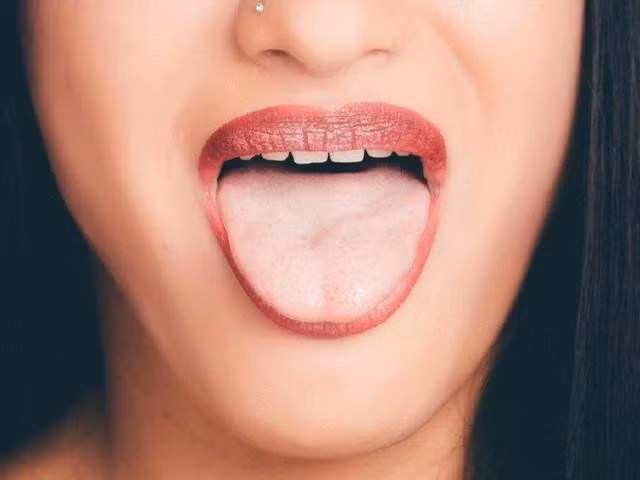 Tế bào ung thư có thể xuất hiện ở bất kỳ vị trí nào trên lưỡi, từ gốc đến phần dưới lưỡi