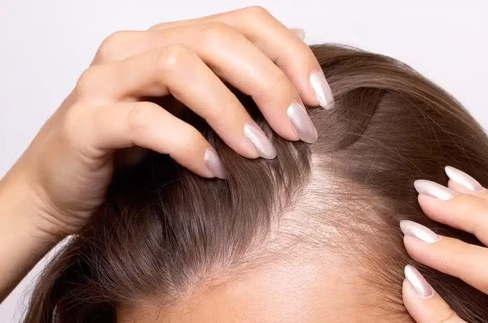 Một số thành phần của chế độ ăn uống có thể khiến bạn bị rụng tóc hoặc ngược lại là giúp tóc bạn dày thêm - Ảnh minh họa: NEWS MEDICAL