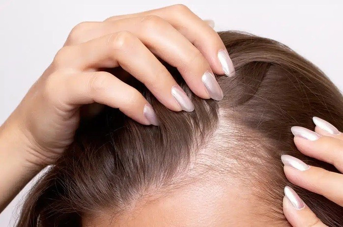 Một số thành phần của chế độ ăn uống có thể khiến bạn bị rụng tóc hoặc ngược lại là giúp tóc bạn dày thêm - Ảnh minh họa: NEWS MEDICAL Một số thành phần của chế độ ăn uống có thể khiến bạn bị rụng tóc hoặc ngược lại là giúp tóc bạn dày thêm - Ảnh minh họa: NEWS MEDICAL