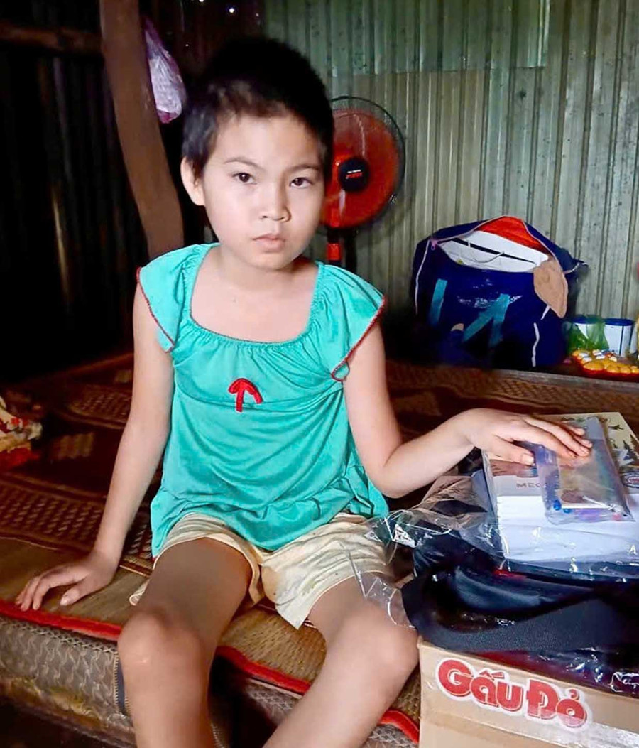 Ca mổ thành công đã giúp em Siu Diệu thoát khỏi cơn nguy kịch, nhưng hành trình hồi phục phía trước vẫn còn rất dài. Ảnh: P.D