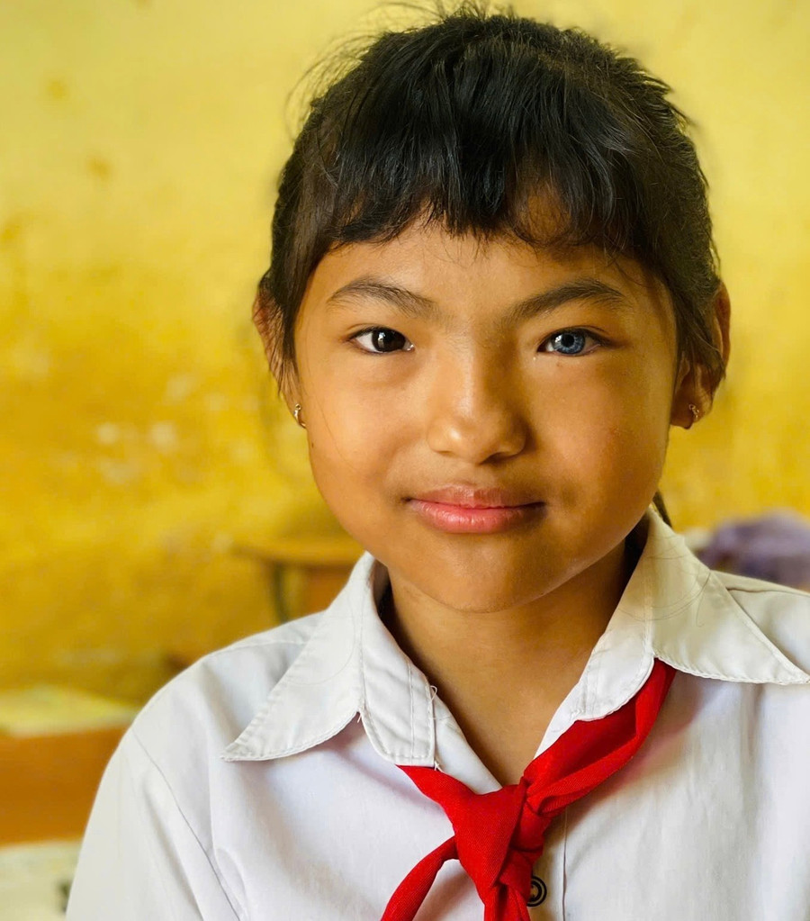 Yến Đan sở hữu đôi mắt một bên đen thẳm như đất mẹ, một bên lại xanh biếc như dòng suối đầu nguồn.