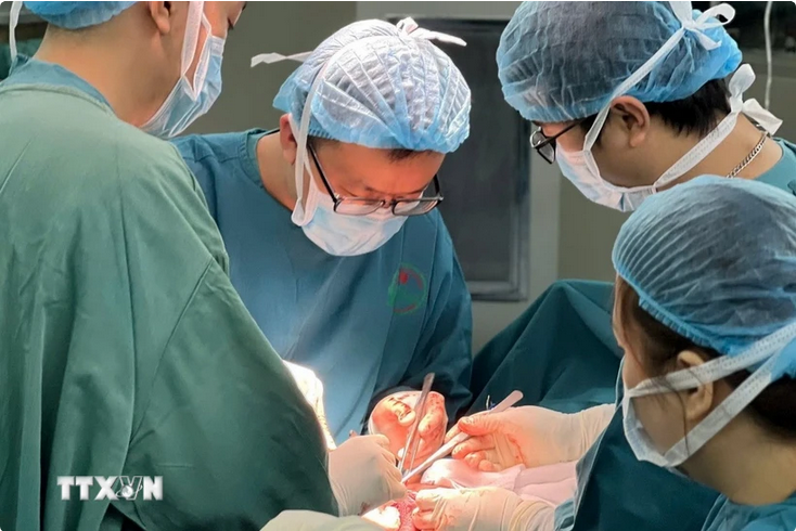 Êkip bác sỹ thực hiện ca phẫu thuật đồng thời cắt thực quản và gan cho nam bệnh nhân. (Ảnh: TTXVN phát) screenshot-2025-06-28-at-10-25-31-da-nang-phau-thuat-dac-biet-cat-thuc-quan-gan-cho-benh-nhan-vietnam-vietnamplus.png