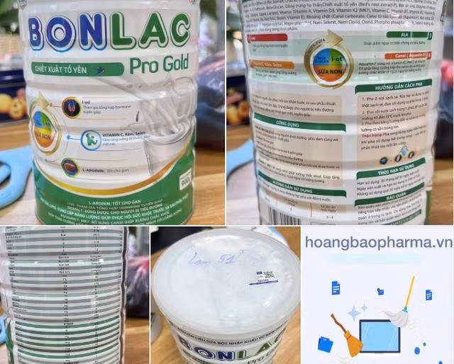 Hộp sữa BonLac bà Hương mua theo chỉ định của bác sĩ khi nhập viện mổ chân vào tháng 12.2024 tại Bệnh viện V.Đ. ẢNH NVCC