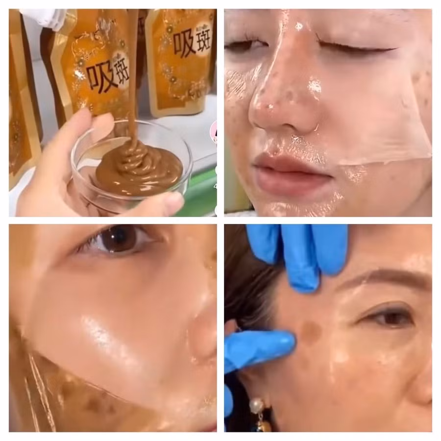 Sản phẩm được quảng cáo trên mạng khẳng định "đánh bay mọi mảng nám lâu năm trên mặt".