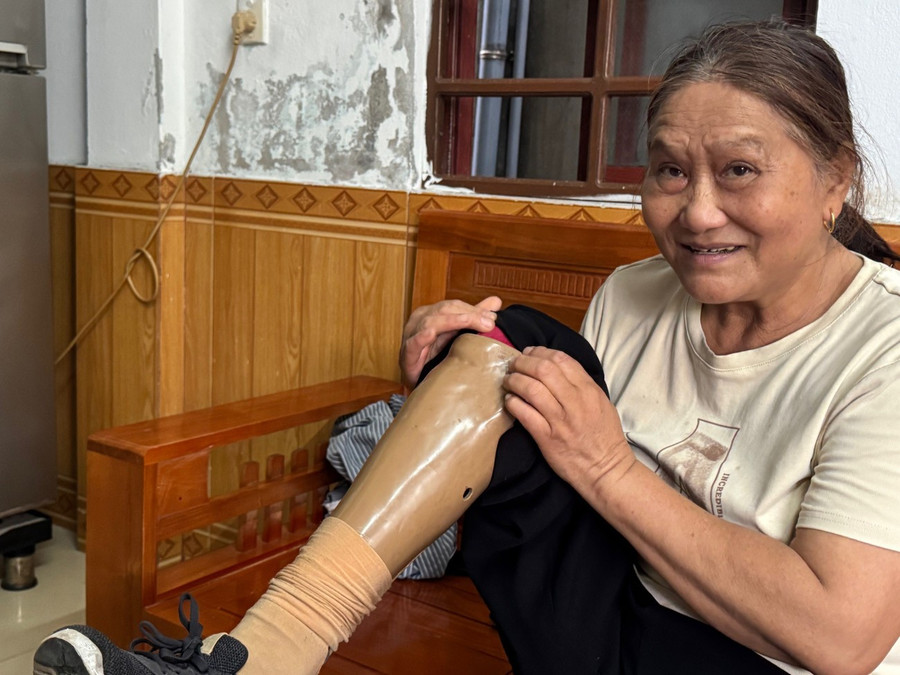 Bà Cảm “khoe” cái chân gỗ - hậu quả của việc dẫm phải mìn khi tham gia xây dựng công trình thuỷ lợi Nam Thạch Hãn. 3phongsu.jpg