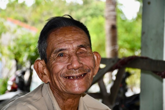 Ông Nguyễn Bảy có làn da nâu đen, cặp chân mày rậm đặc trưng của người Đàng Hạ. 2-bi-an-toc-nguoi.jpg