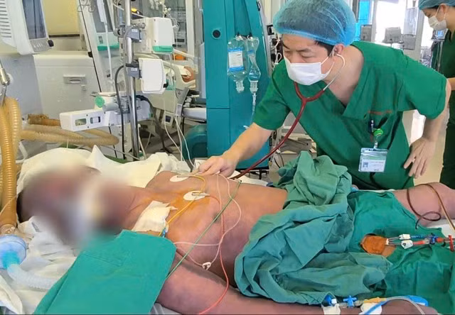 nam-benh-nhan-nhiem-lien-cau-khuan-lon-nhap-vien-trong-tinh-trang-nguy-kich-anh-dang-thanh.jpg