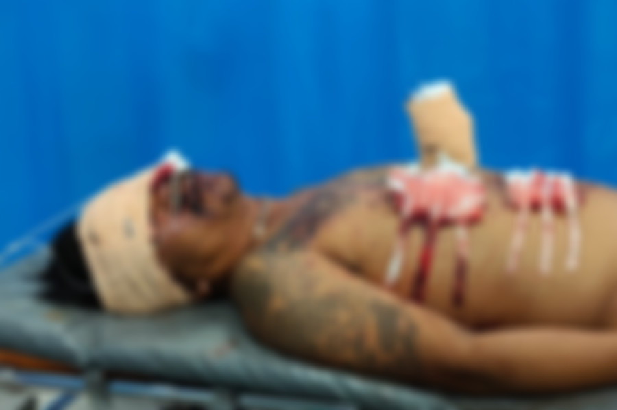 Nạn nhân đang cấp cứu tại Bệnh viện Hùng Vương. Ảnh: CTV Nạn nhân đang cấp cứu tại Bệnh viện Hùng Vương. Ảnh: CTV