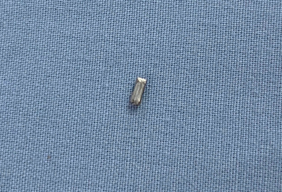 Dị vật được lấy ra từ mắt của bệnh nhân Nguyễn Anh Sơn. Ảnh Bệnh viện cung cấp Dị vật được lấy ra từ mắt của bệnh nhân Nguyễn Anh Sơn. Ảnh Bệnh viện cung cấp