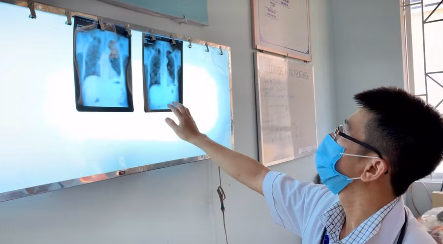 Chiến dịch mở rộng hoạt động sàng lọc lao tại cộng đồng bằng chiến lược 2X (X-quang, Xpert ) triển khai trên địa bàn 14 xã của huyện Chư Prông từ ngày 4 đến 17-12. Ảnh: Như Nguyện