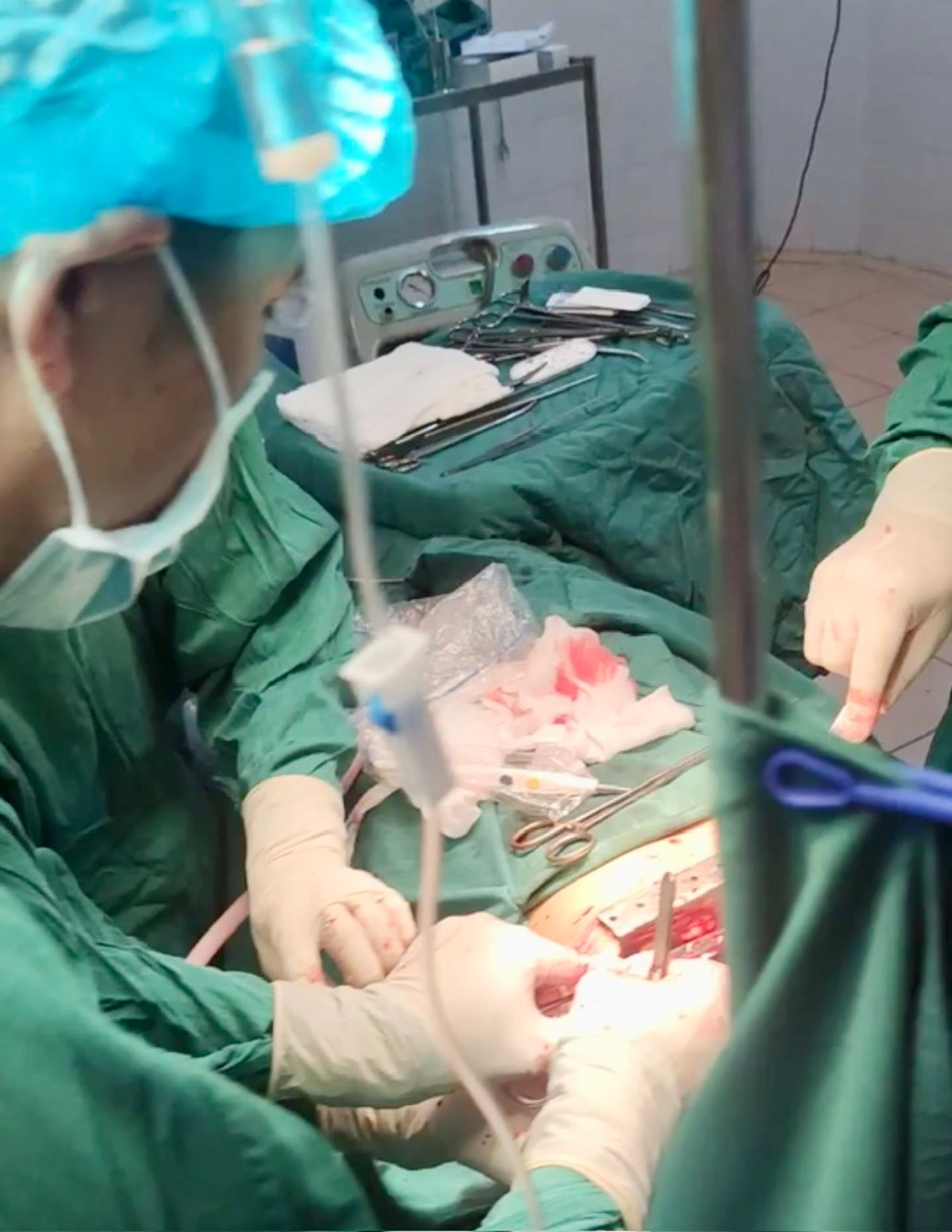 Ê kíp y, bác sĩ tiến hành phẫu thuật cho bệnh nhân. Ảnh: Như Nguyện