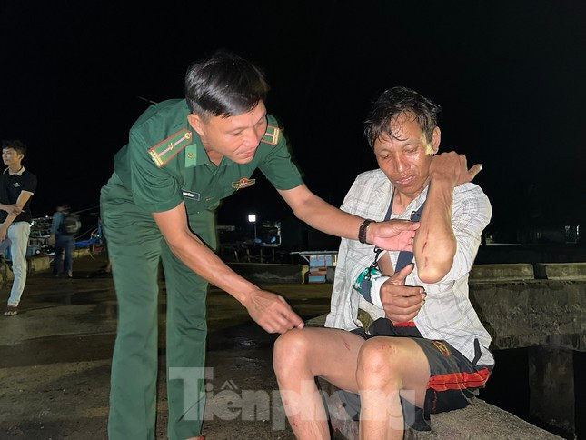 Hậu quả, khiến ngư dân Huỳnh Văn Hoanh (chủ tàu, máy trưởng) bị gãy tay phải và ngư dân Huỳnh Văn Tiến (thuyền trưởng) bị chấn thương vùng đầu. (Ảnh: Nguyễn Ngọc) Hậu quả, khiến ngư dân Huỳnh Văn Hoanh (chủ tàu, máy trưởng) bị gãy tay phải và ngư dân Huỳnh Văn Tiến (thuyền trưởng) bị chấn thương vùng đầu. (Ảnh: Nguyễn Ngọc)