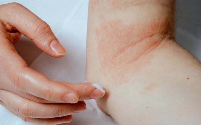 (Nguồn: Getty images)