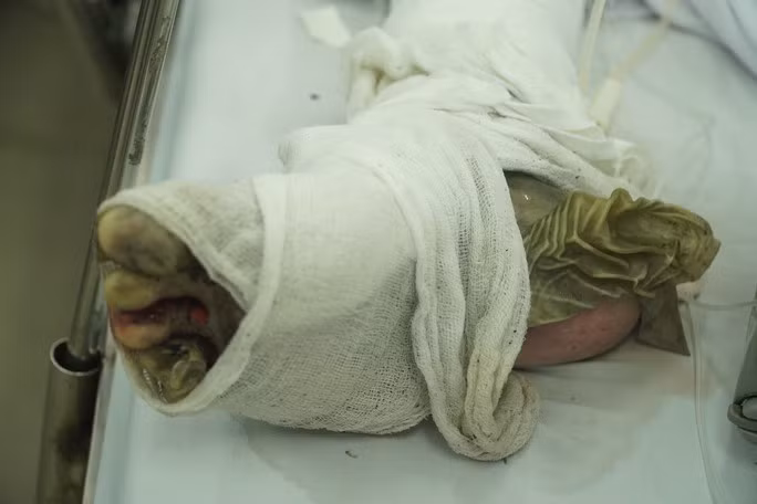 Hiện chưa thể nói trước được điều gì về tình trạng các nạn nhân