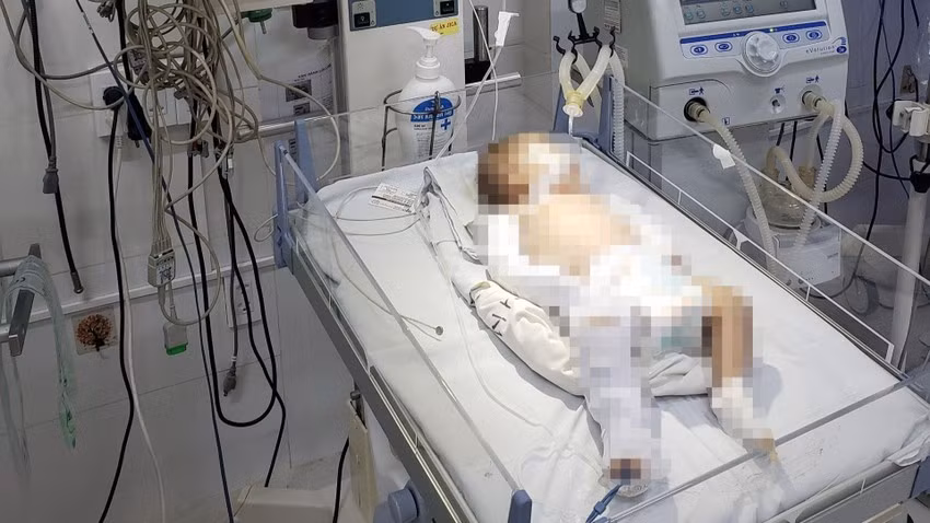 Cháu C. đang được điều trị tích cực tại bệnh viện. Ảnh: VTV