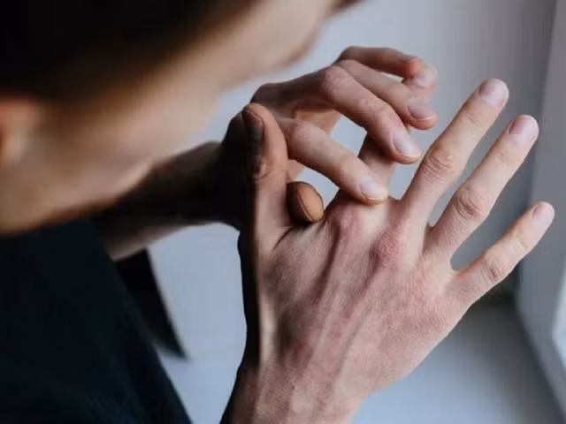 Người bệnh cần hạn chế làm trầy xước vùng da ngứa, xác định các yếu tố gây dị ứng để phòng tránh. ẢNH: SHUTTERSTOCK