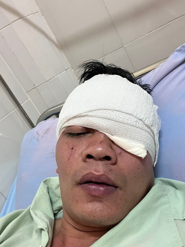 Đà Lạt: Một người đàn ông bất ngờ bị đánh trong nhà hàng trước mặt vợ con - Ảnh 4. Anh T. đang điều trị tại Bệnh viện đa khoa Lâm Đồng. Ảnh: L.V.