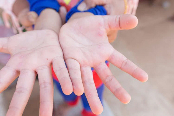 Ảnh minh họa. Ảnh minh họa.