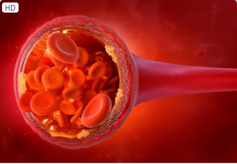 Ăn khoảng 1 nắm quả óc chó mỗi ngày trong 2 năm đã giảm mức cholesterol "xấu" (LDL) cũng như số lượng hạt LDL liên quan đến nguy cơ bệnh tim mạch. Ảnh: SHUTTERSTOCK Ăn khoảng 1 nắm quả óc chó mỗi ngày trong 2 năm đã giảm mức cholesterol "xấu" (LDL) cũng như số lượng hạt LDL liên quan đến nguy cơ bệnh tim mạch. Ảnh: SHUTTERSTOCK