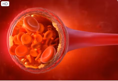 Ăn khoảng 1 nắm quả óc chó mỗi ngày trong 2 năm đã giảm mức cholesterol "xấu" (LDL) cũng như số lượng hạt LDL liên quan đến nguy cơ bệnh tim mạch. Ảnh: SHUTTERSTOCK
